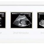 Pearhead Triple Sonogram Pregnancy Keepsake Frame, Watch Baby Grow Through all Three Trimesters – Great Gift For Expecting Parents, White